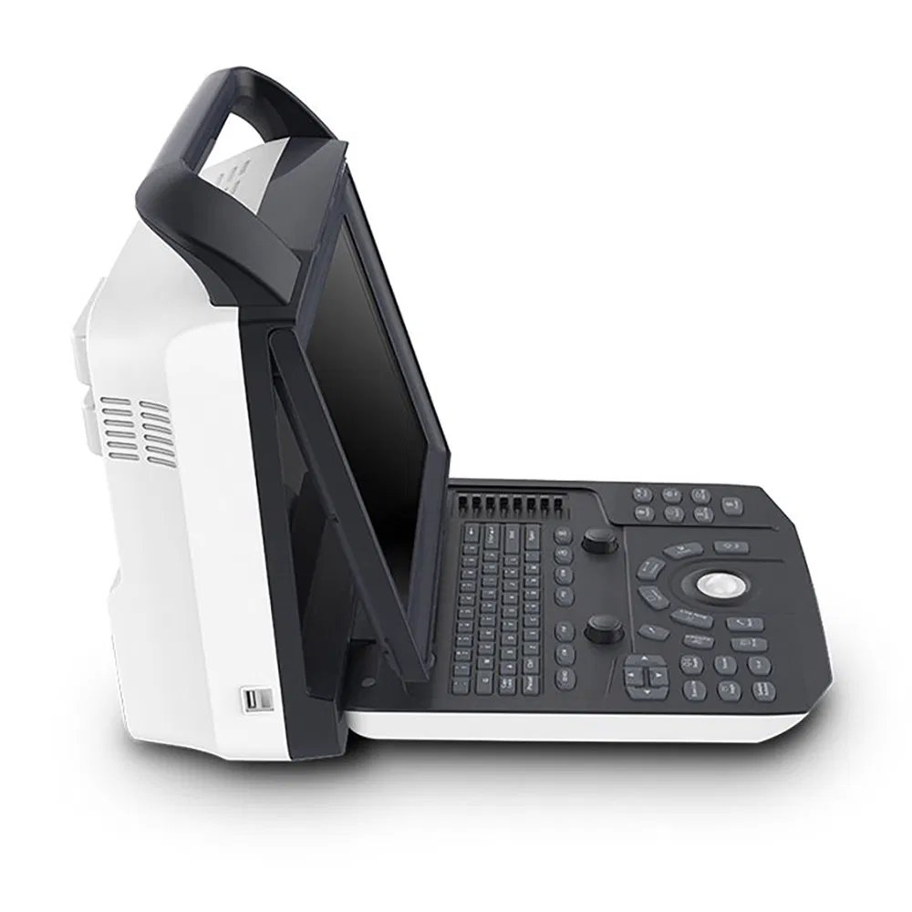 Portable-Medical-Color-Doppler-Ultrasound-Ecografo-Zoncare-M5-System-3D-4D-Color-Doppler-Laptop-Ultrasound-79
