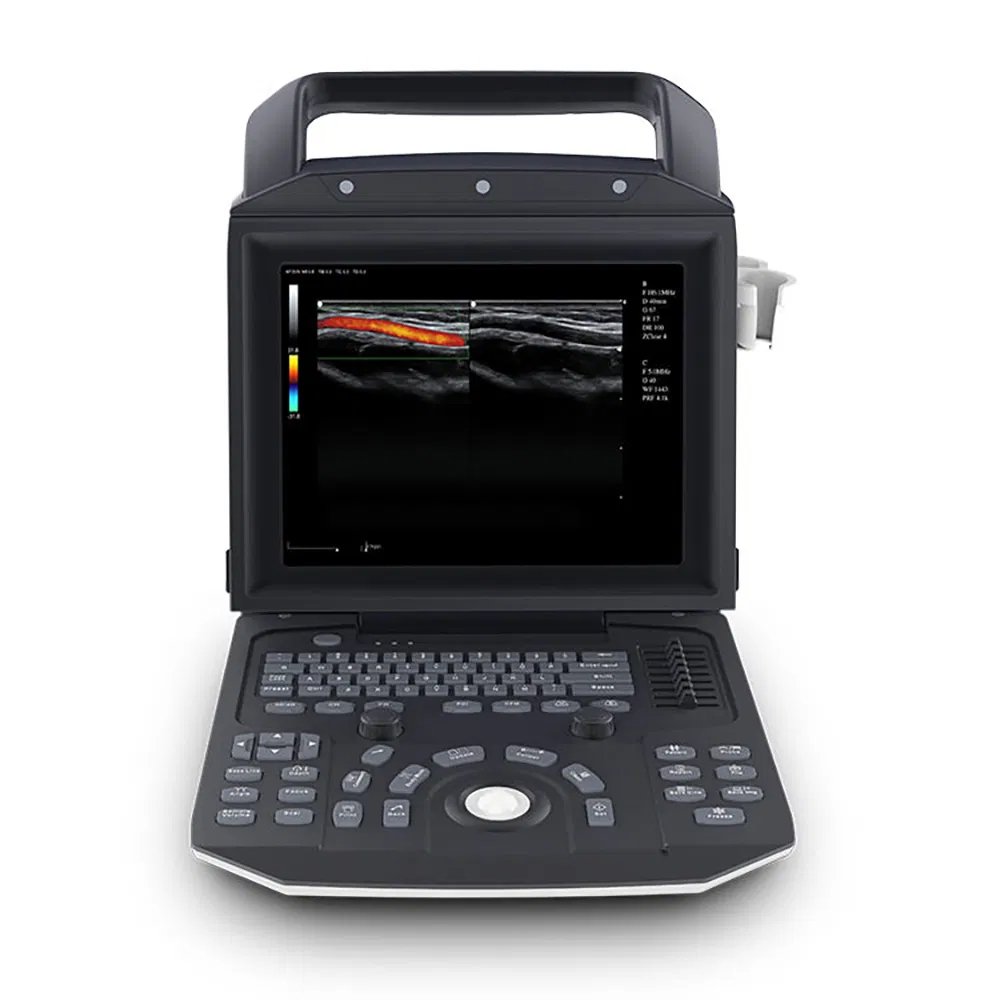 Portable-Medical-Color-Doppler-Ultrasound-Ecografo-Zoncare-M5-System-3D-4D-Color-Doppler-Laptop-Ultrasound-903